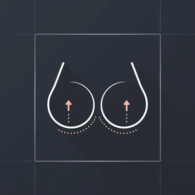 Breast Lift (Mastopexy)