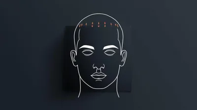 Hair Transplant (FUE & FUT)